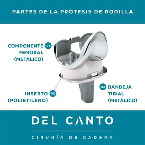 Tipos De Prótesis De Rodilla – Prótesis de rodilla – SLBGR