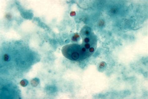 Entamoeba Histolytica Trophozoite 1000x FEPN Parasite Pages