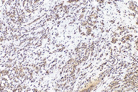 HMGB1 antibody (10829-1-AP) | Proteintech