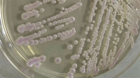 微生物真菌生长