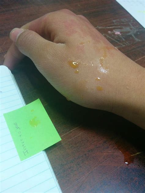 Is it weird this yellow liquid just started dripping out of my nose? : WTF