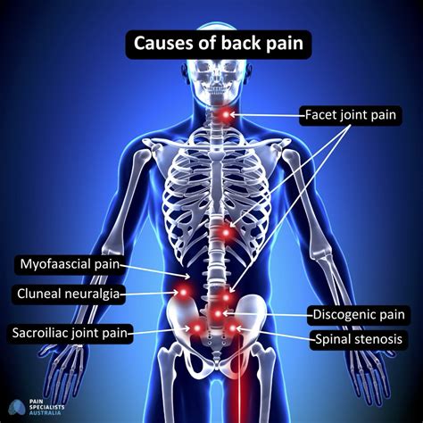 Anatomy Lower Back Treatment For Lower Back Pain | Clinical Massage