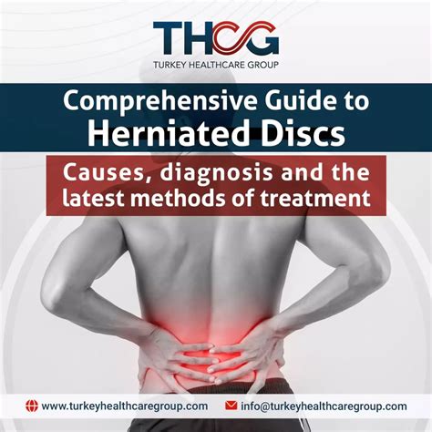 Comprehensive Guide to Herniated Discs 2024 Causes, diagnosis and the latest methods of ...
