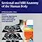 Buy Sectional and Mri Anatomy of the Human Body: A Photographic Atlas ...