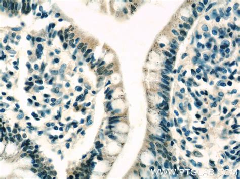 FOXM1 antibody (13147-1-AP) | Proteintech