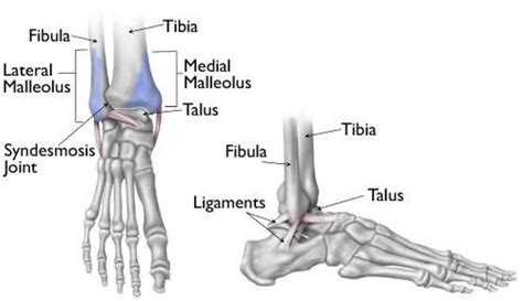Bimalleolar fracture causes, symptoms,diagnosis, treatment & recovery