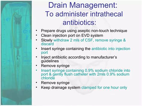 External Ventricular Drain | PPT