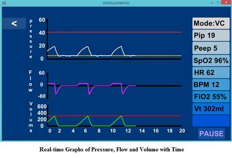 Mechanical Ventilator