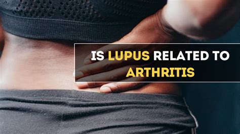 Is LUPUS Related To Arthritis?