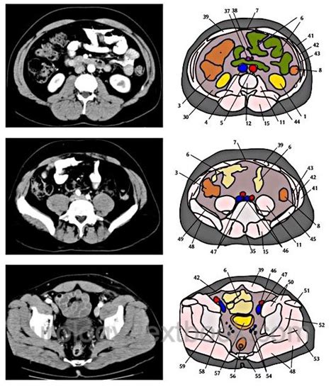 CT Scan 的图像结果