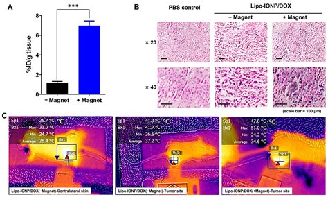 Liposomal Iron Oxide Nanoparticles Loaded with Doxorubicin for Combined ...