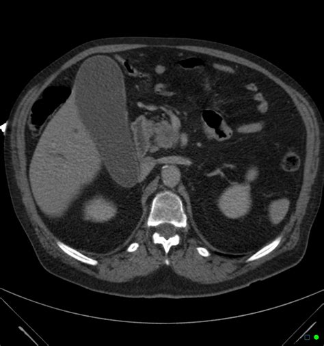 Courvoisier Terrier Sign