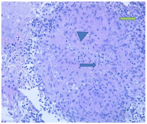 Antibiotics | Special Issue : Antibiotics and Infectious Respiratory ...