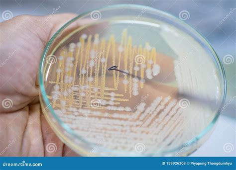 Colony Characteristics of Yeast in Petri Dish. Stock Photo - Image of fungi, culture: 159926308