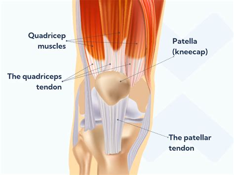 Quadriceps Tendonitis Exercises