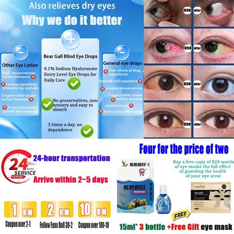 Eye Drops 眼药水 Blurred Vision Drop Itchy Dry Eye Drops Eyes Overuse eye drops Super Effective ...