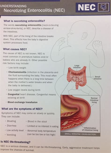 Understanding Necrotizing Entercolitis (NEC) #NEC | Nicu nurse ...