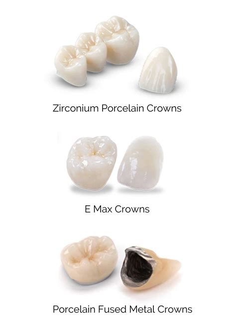 Different Types Of Zirconia Crowns at Patricia Henderson blog