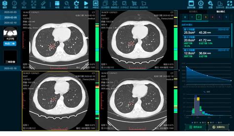 Ai 影像筛查 的图像结果