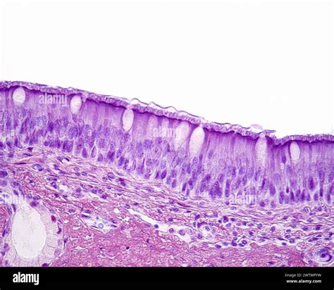 Pseudostratified Ciliated Columnar Epithelium Solved (a) Survey