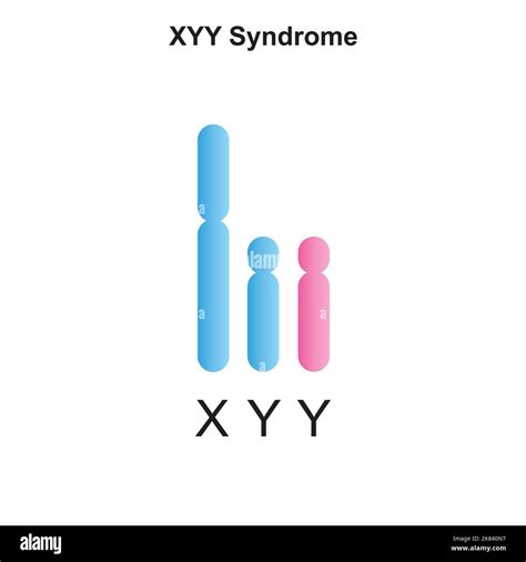 Pictures Of People With Xyy Syndrome