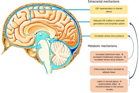 Idiopathic intracranial hypertension: Imaging and clinical fundamentals