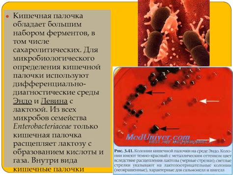 Кишечные инфекции