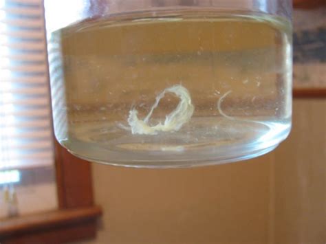 Vinegar smelling urine-13 Causes, Symptoms, 4 Treatments