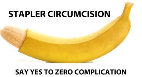 CIRCUMCISION - Laser360clinic.com