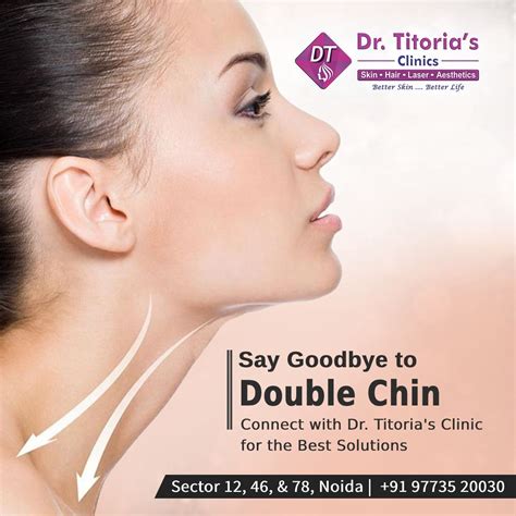 Non surgical facial treatment in hyderabad – Artofit