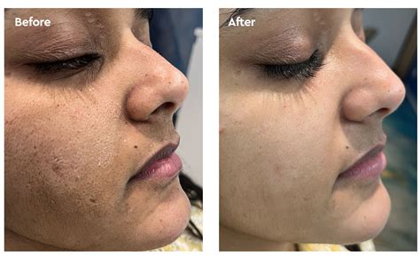 Within Beauty Daily Dew Barrier Restore Gel Moisturiser 50ml