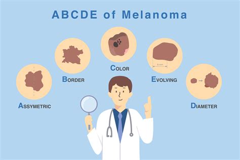 Spotting Skin Cancer Early: The ABCDEs of Melanoma | R&R Lotion®