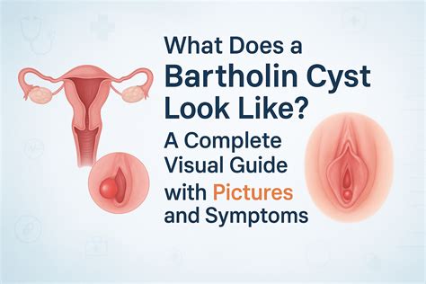 What Does a Bartholin Cyst Look Like? Pictures & Visual Guide 2025