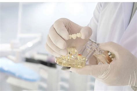 Dental Implant Restoration in Bowling Green - Implant Crowns
