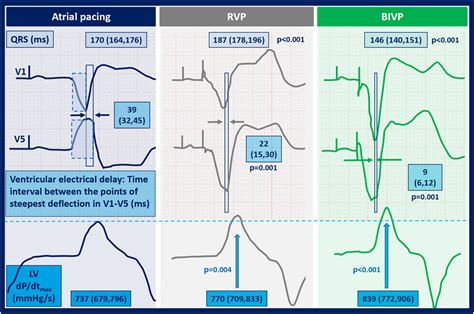 Changes in electrical delay is associated with the hemodynamic response ...