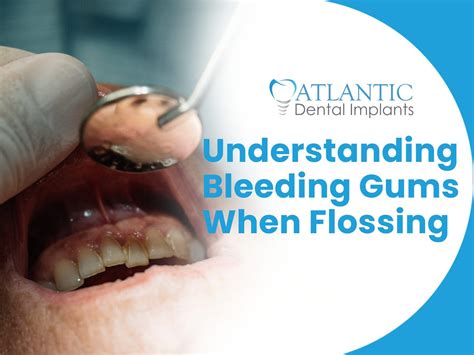 Bleeding Gums When Flossing | Atlantic Dental Group