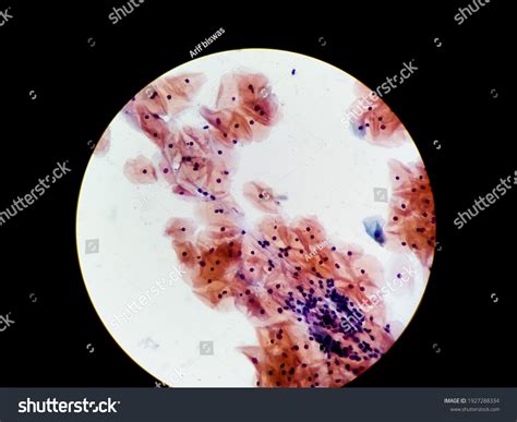 Cheek Epithelial Cells Bacteria