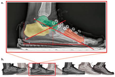 Bioengineering | An Open Access Journal from MDPI