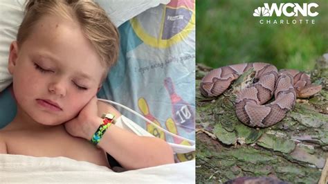Family's smart response to copperhead bite saves 4-year-old boy | wcnc.com