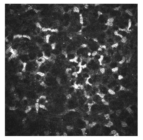 Update on Corneal Confocal Microscopy Imaging