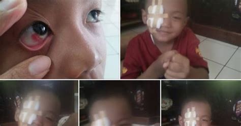 Mata Anak Ini berdarah, Diduga akibat Sering Main Gadget - KARYAKU