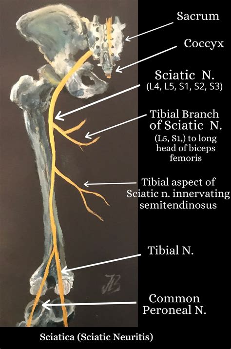 Sciatica, Lower Back Pain & the Sciatic Nerve