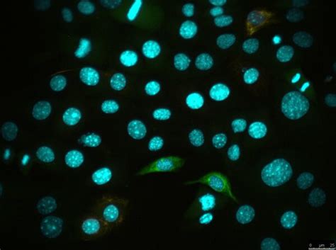 Py2T Mouse Mammary Tumor Cell Line | SCC416