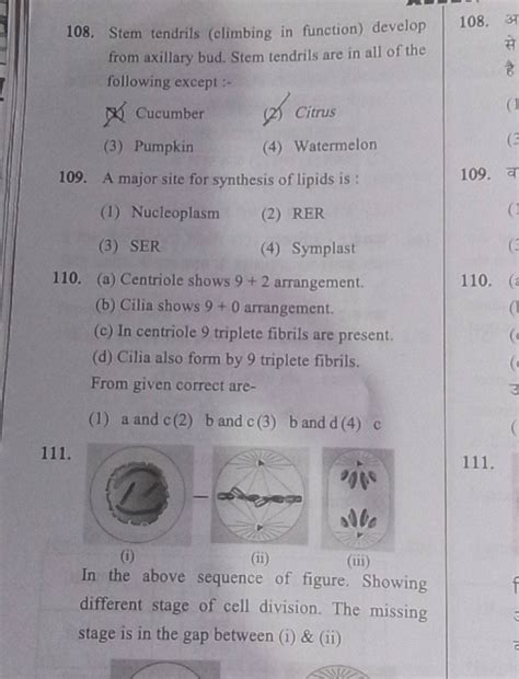 (a) Centriole shows 9+2 arrangement. (b) Cilia shows 9+0 arrangement. (c)..