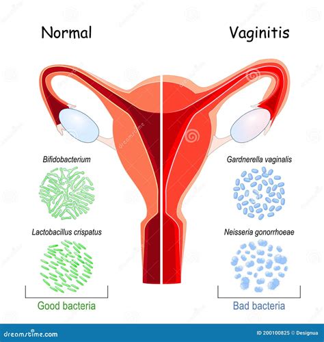 Vaginal Flora Meaning