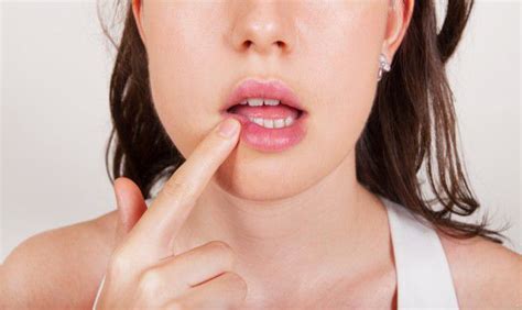 【图】嘴巴周围起痘痘怎么办 教你八大方法让你恢复嫩白瓷肌(3)_伊秀美容网|yxlady.com
