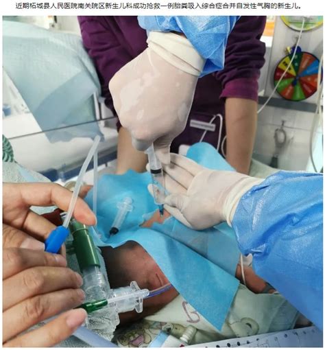 我院成功抢救一例胎粪吸入综合症合并自发性气胸新生儿-柘城县人民医院