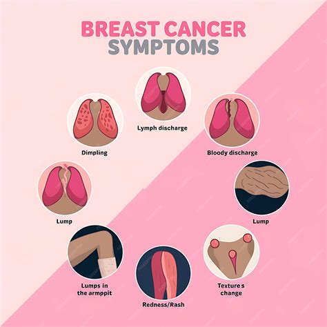 Guía visual infográfica de los síntomas del cáncer de mama con ocho signos clave | Imagen ...