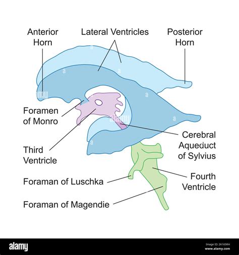 Interventricular Foramen Monro