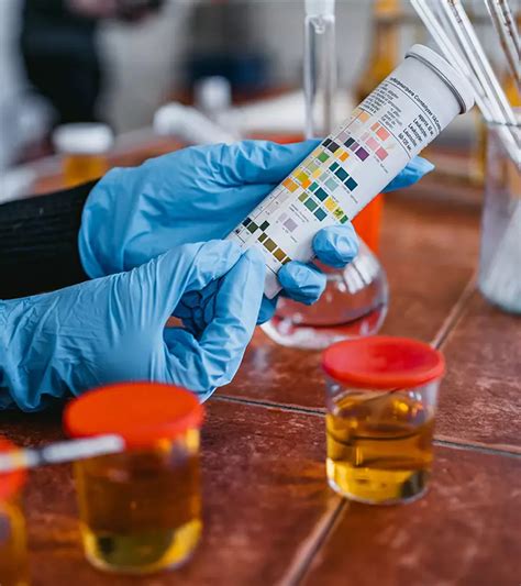 Cloudy Urine During Pregnancy: 6 Causes, Diagnosis & Treatment